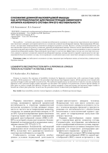 Реконструкция связок колена аутотрансплантатом